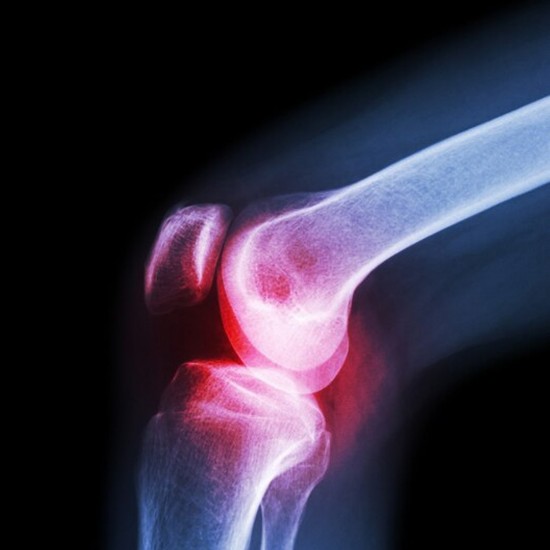 6233-xl-knee-cap-for-knee-support